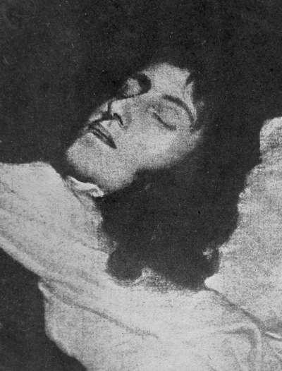 head with eyes closed resting on a pillow with covers up to his chin